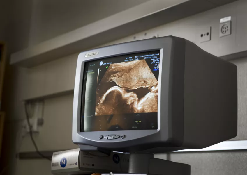 Ultrasound of a foetus